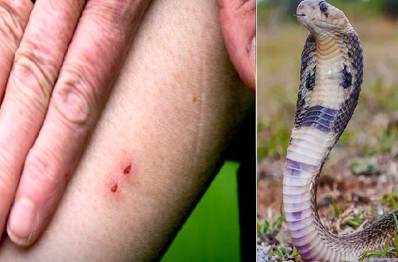 கிளிநொச்சியில் பாம்பு கடித்து இளைஞன் உயிரிழப்பு !